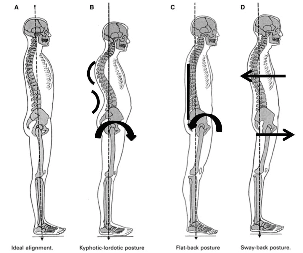 Guide to Plumb Line Assessment for Posture image (6)