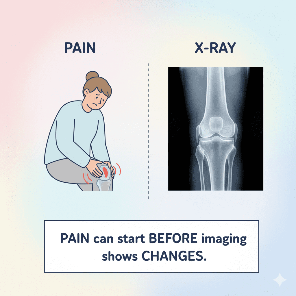 Why the Knee Hurts Before “Arthritis” Is Diagnosed arthritis 3