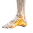 Home Plantar Fasciitis